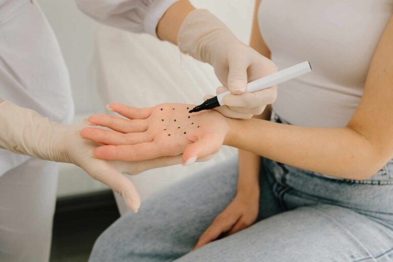 marking-dots-on-palm-for-filler-injection-to-treat-JGKPC3Y.jpg